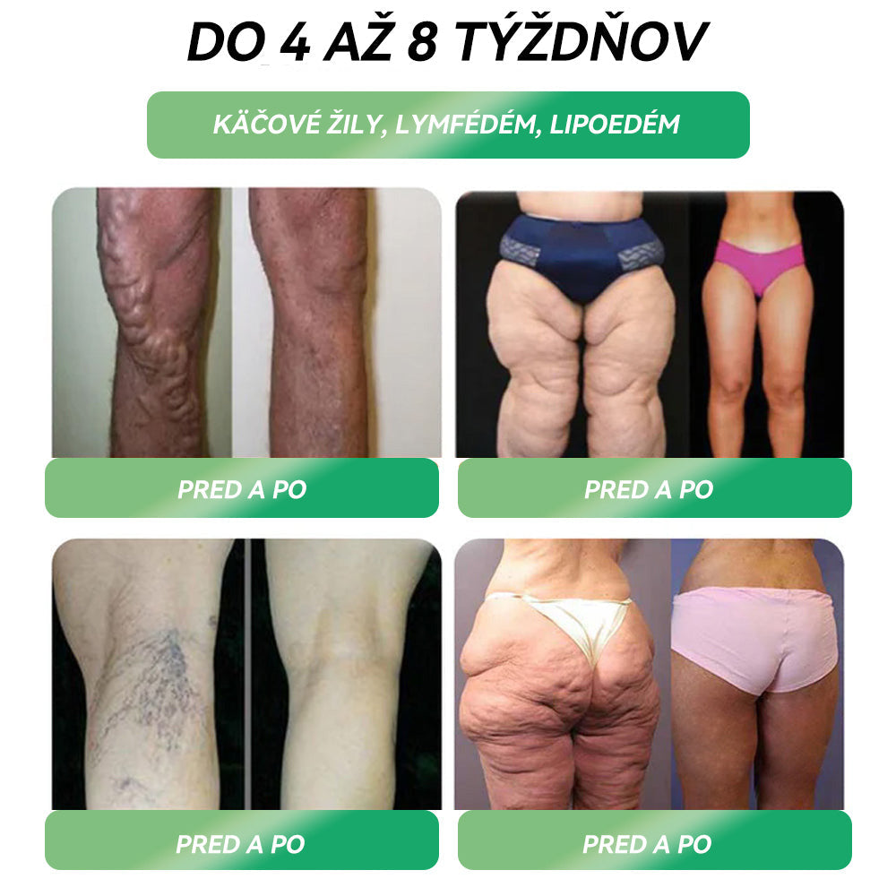 ✅ Odporúča viac ako 100 000 ľudí | Oficiálny obchod | 𝐒𝐓𝐃𝐄™👨‍👧‍👧👨‍👧‍👧 𝐆𝐋𝐏-𝟏  𝐜𝐡𝐮𝐝𝐧𝐮𝐭𝐢𝐞 𝐩𝐞𝐫𝐨𝐫á𝐥𝐧𝐲 𝐫𝐨𝐳𝐭𝐨𝐤 - Obezita, kardiovaskulárne ochorenia, cukrovka, spánkové dýchanie, problémy s kĺbmi a ďalšie